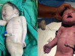 mermaid-syndrome_20171210_083517.jpg