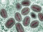 mikroskop-elektron-dari-virus-u-an-cacar.jpg