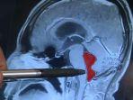 mri-gerardo.jpg