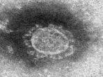 mutan-baru-virus-corona-e484k.jpg