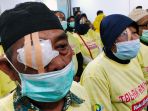 Katarak Penyebab Kebutaan Tertinggi di Indonesia, Mayoritas Penderitanya 50 Tahun ke Atas
