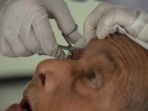 operasi-katarak-gratis-di-surabaya_20161121_215225.jpg