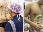 operasi-perut-agar-menjadi-six-pack-pun-laris-manis-di-thailand.jpg