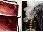 paru-paru-pengguna-vape.jpg