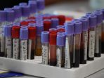 pelindo-iii-gelar-screening-donor-plasma-konvalesen_20210121_221250.jpg