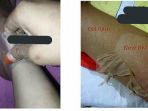 pemutih-kulit-ekstrim_20180504_091009.jpg
