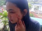 penganiayaan_20160411_205426.jpg