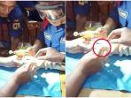 petugas-damkar-berusaha-melepaskan-cincin-dari-seorang-pria.jpg