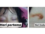 postingan-viral-mata-anak-keluar-cairan-mirip-darah-akibat-radiasi-hp.jpg