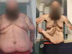 pria-asal-chicago-jp-38-saat-belum-melakukan-diet-ihih.jpg