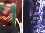 pria-asal-tiongkok-ini-alami-kesulitan-bernapas-gara-gara-kebiasaan-duduk-di-sofa-sampai-main-ponsel.jpg