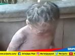 r-5-bocah-yang-bersisik-sejak-lahir-kamis-692018_20180907_071618.jpg