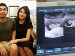raditya-dika-dan-anissa-aziza_20181019_133312.jpg