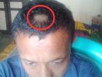 rambut-guru-pitak-dipotong-wali-murid.jpg