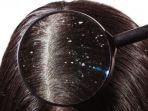 rambut-ketombe1.jpg