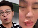 richard-lee-tahu-soal-sakit-kartika-putri-dari-warganet.jpg
