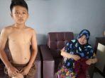 rizki-seorang-pelajar-yang-disengat-tawon-menunjukan-luka-di-tubuhnya-kamis-21112019.jpg