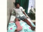 saktiawan-sinaga-otot-tendon-putus_20150614_121820.jpg