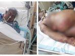 salah-penanganan-dokter-pria-ini-idap-penyakit-kulit-langka-hingga-meninggal-dunia.jpg