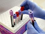 screening-donor-plasma-covid-19_20210730_201056.jpg