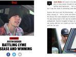 selain-lyme-disease-justin-bieber-ternyata-juga-mengidap-mono-kronis.jpg