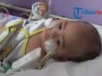 sembilan-kali-operasi-pasien-hemofilia-berharap-bantuan-dana_20150419_165938.jpg