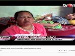 seorang-wanita-di-kuningan-jawa-barat-bernama-teti-darmiati-manusia-kayu.jpg