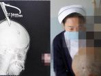 shen-dengan-gunting-menancap-di-kepalanya_20180408_160521.jpg
