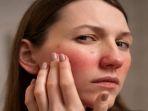 skin-barrier-rusak_4.jpg
