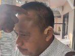 slamet-suyanto-menunjukkan-luka-usai-dianiaya-perangkat-desa.jpg