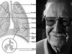 stan-lee-dan-pneumonia_.jpg