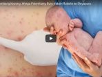stok-di-palembang-kosong-warga-palembang-buru-vaksin-rubella-ke-singapura_20170918_141001.jpg