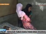 sulami-manusia-kayu-asal-sragen-jateng_20170120_104951.jpg