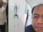 sutopo-purwo-nugroho-berjuang-melawan-kanker-paru-paru.jpg