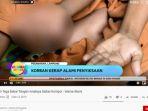 tangan-am-yang-terkena-luka-bakar-serius-akibat-disiksa-ibu-tiri.jpg