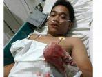 tangan-korban-begal-putus.jpg