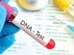 Tes DNA Sejak Dini Mampu Cegah Penyakit Genetik Langka