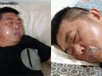 tidur-mulut-diselotip_20171229_153720.jpg