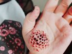 trypophobia_20170731_173726_20170731_205441.jpg