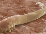 tungau-jenis-demodex-folliculorum_20180801_224737.jpg