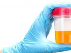 urine-tes_20141117_104559.jpg