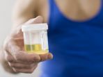 urine_20170306_132210.jpg