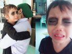 viral-kena-usil-ibunya-saat-tidur-bocah-ini-tak-berhenti-menangis-lihat-matanya-menghitam.jpg