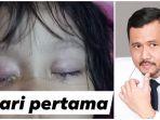viral-postingan-mata-anak-keluar-cairan-mirip-darah1.jpg