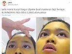viral-seorang-gadis-memakai-masker-kunyit-di-wajah-1.jpg