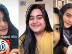 viral-sosok-gadis-remaja-memiliki-kumis-dan-jenggot-di-wajahnya-begini-kisahnya.jpg
