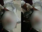 viral-video-jenazah-pasien-covid-19-dicongkel-mata-dan-darah-bercucuran.jpg