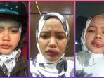 viral-wanita-bagikan-pengalamannya-digigit-serangga-bibirnya-gatal-gatal-sampai-membengkak.jpg