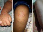 virus-singapura1.jpg
