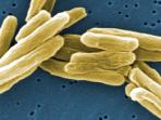 virus-tbc-tuberculosis_20151210_155824.jpg